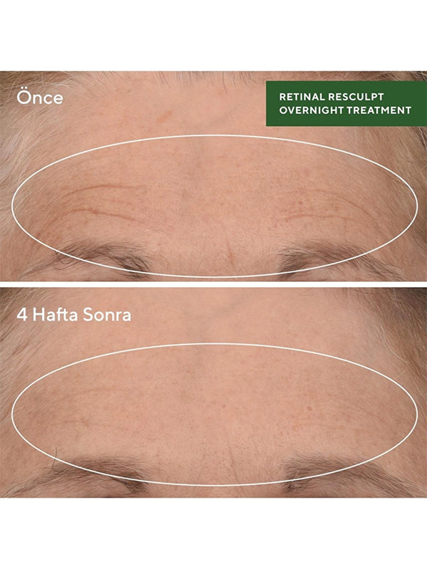 MURAD - SERUM - Retinal Resculpt Overnight Treatment - 30 ml - shopi go'da!.