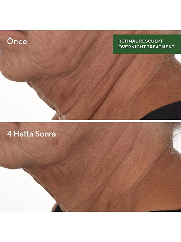 MURAD - SERUM - Retinal Resculpt Overnight Treatment - 30 ml - shopi go'da!.